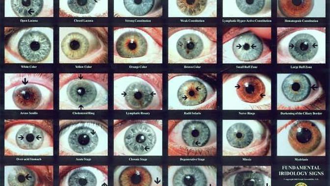 What's your natural eye color?