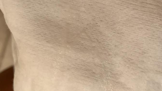 I don’t know if posting this is against the rules, but if it is- feel free to take it down. My discharge looks like this recently and smells funny?