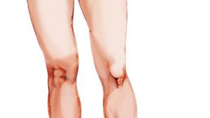 Pear body shape problems, help please?