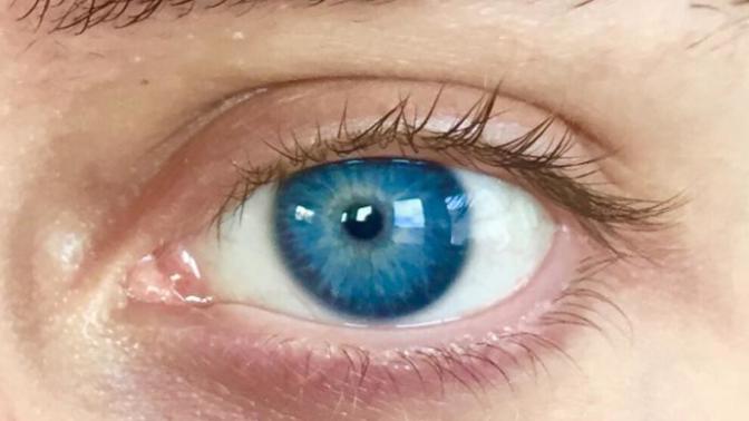 Eyes! Do you get lost in them?