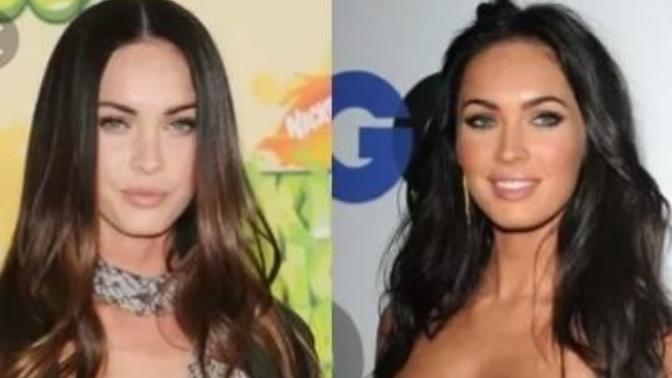 Do you prefer sun tanned or pale skin? Which do you think is more attractive?