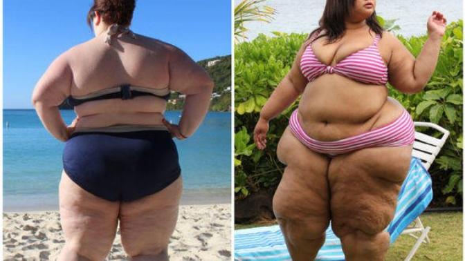 Should overweight people be allowed to wear bikini?