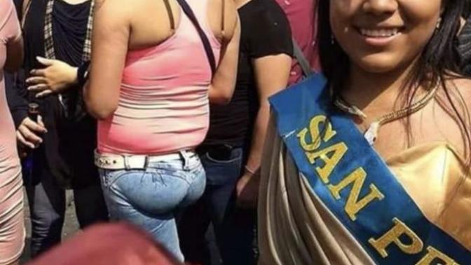 No making fun of he woman in the picture but what do you guys think is up here?