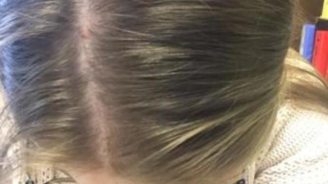 Am I weird that a girl's head top kinda turns me on?