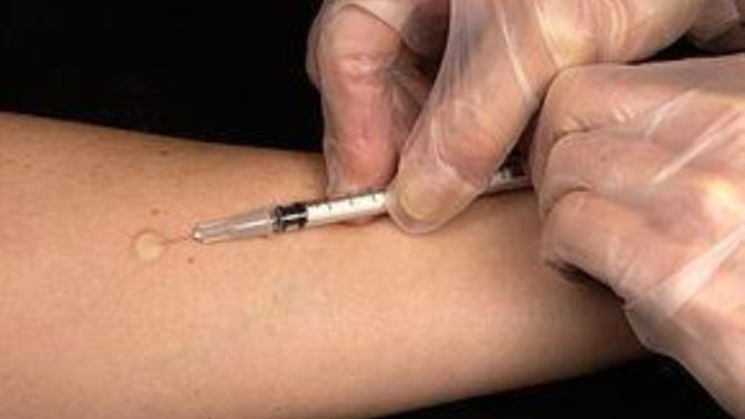 Have you ever gotten a tuberculin skin test?