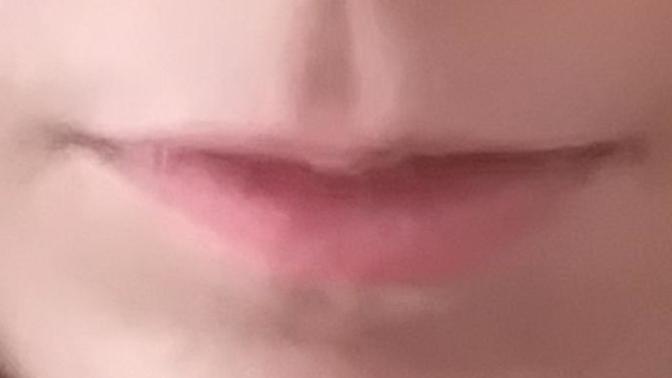 Are my lips ugly (Image)?
