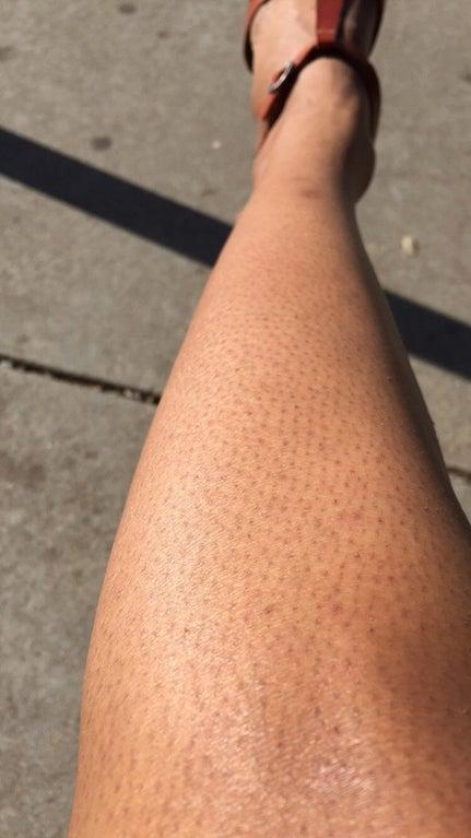 These aren’t my legs by the way