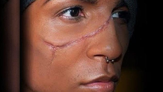 If someone had a lot of scars would it bother you?