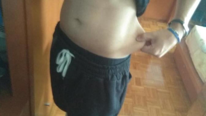 My body skin. What should I do?