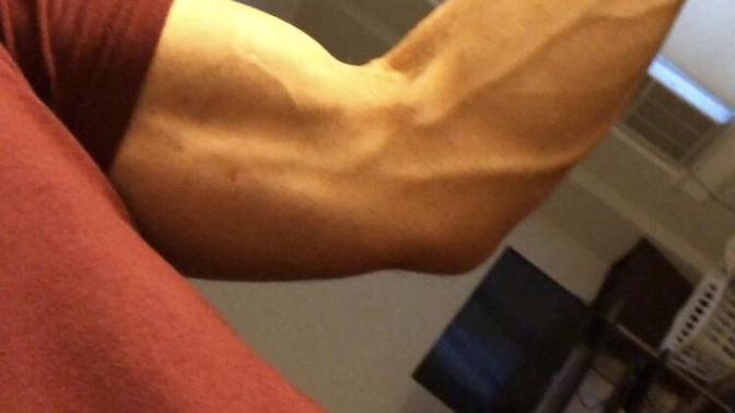Veins: Sexy or Not Really?