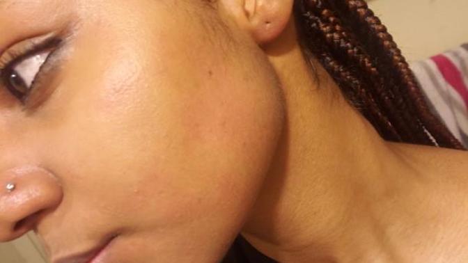 What's happening to my face?