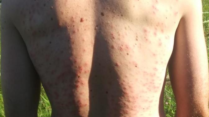What's wrong with my back?