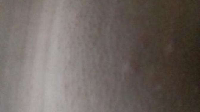 Bumps after first Brazilian wax?