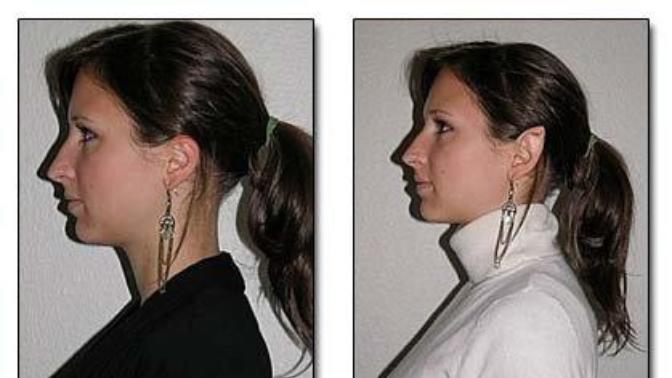 What would you say (or do) if your partner insisted on getting their ears done like this? Is it a dumping offence? Would you be pleased?