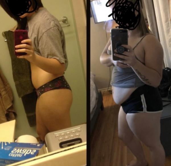 Is it normal for 18 yo girl to gain this much just over the summer?