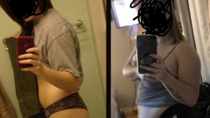 Is it normal for 18 yo girl to gain this much just over the summer?