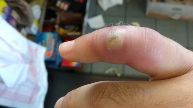 Doctor or nurse, I need help?