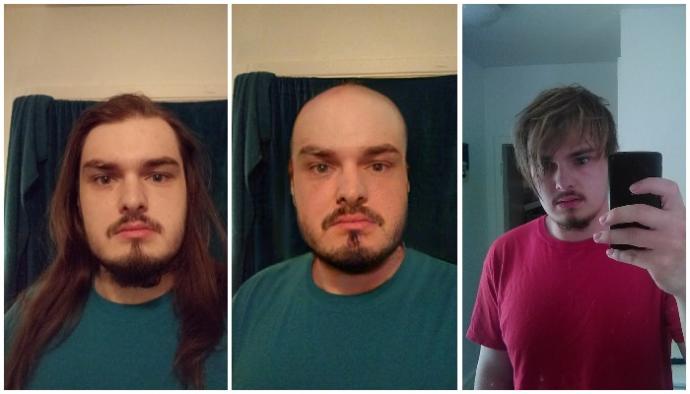 Do I look better with Long Hair or No Hair? What hairstyle would you suggest?