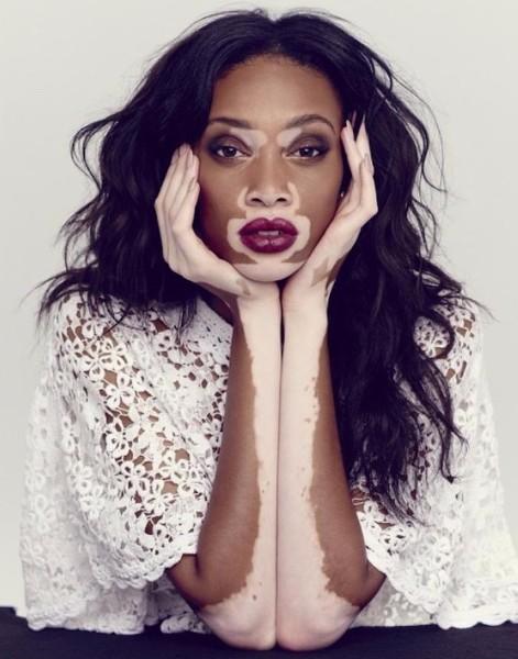 Why is “Unique Beauty” so overlooked?