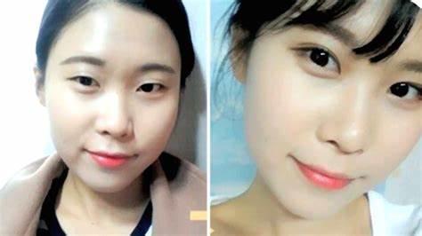 New Asian Eye-Widening Fad in Plastic Surgery! Do you like it?