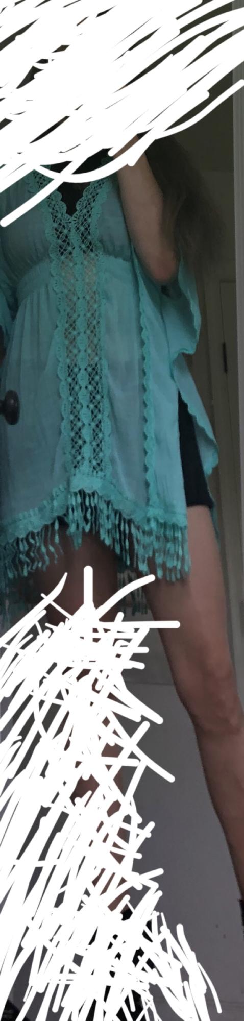 1. Can this pass as an outfit. 2. If possible, suggest Color/type of tights that won’t look lame.(Noticeable cuts/ bruises. Not yet ok going bare)?