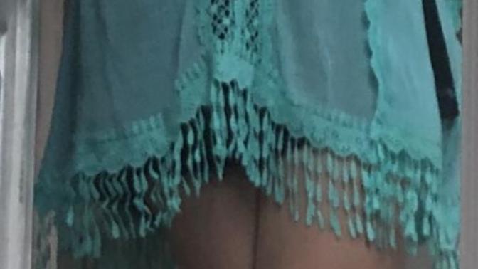 1. Can this pass as an outfit. 2. If possible, suggest Color/type of tights that won’t look lame.(Noticeable cuts/ bruises. Not yet ok going bare)?