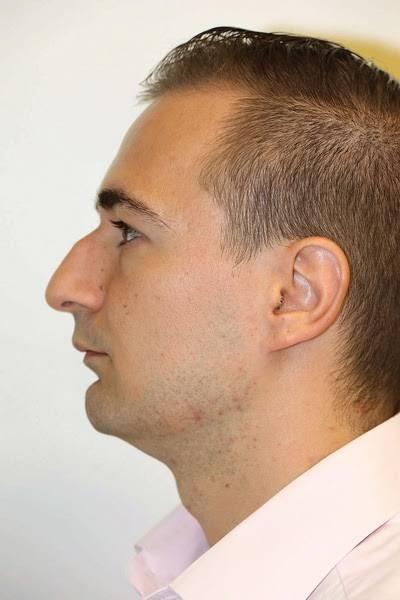 Do you find guys with a nose hump unattractive?