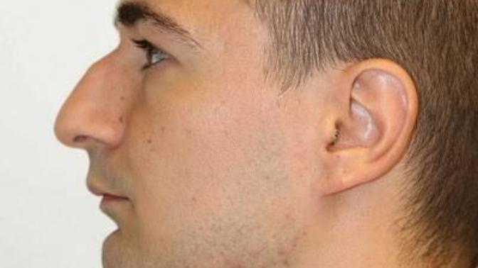 Do you find guys with a nose hump unattractive?
