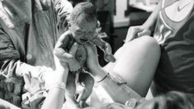 Is birth gross?