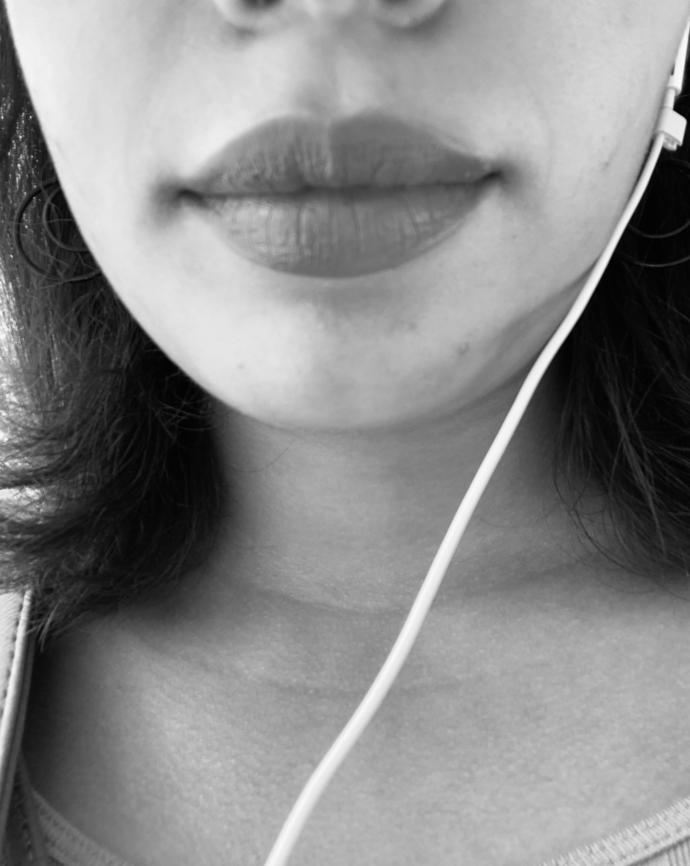 Is it normal to have these fine lines around my mouth at age 18?