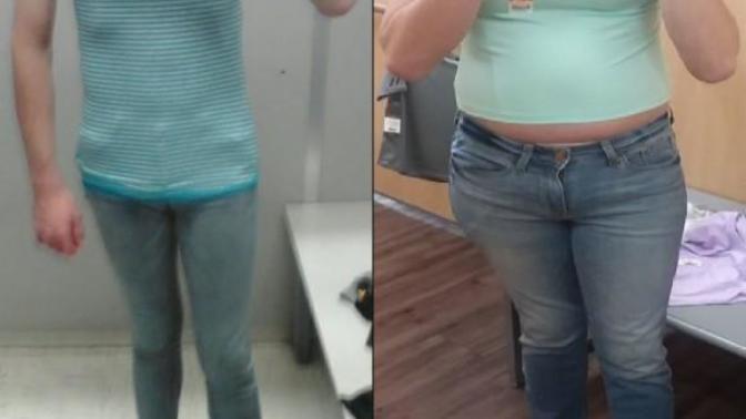 Have You Ever Been On A Medication That Caused Weight Gain?