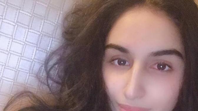 Are my lips thin and do they go with my face? 2?