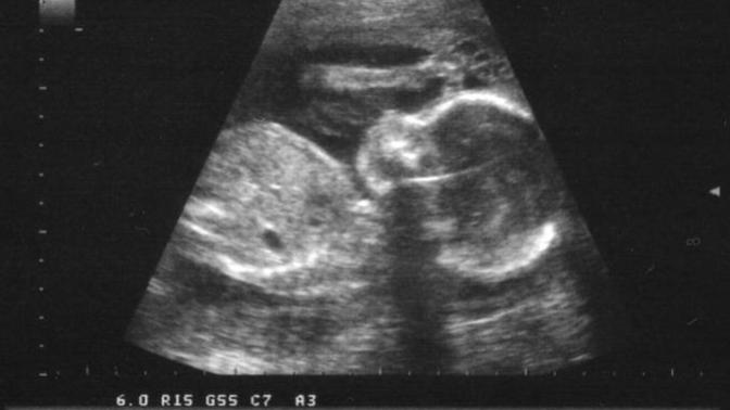 Your partner is pregnant/your having their baby, and it's a boy/girl, and they want to name the baby the same name as an ex of yours. What would you?