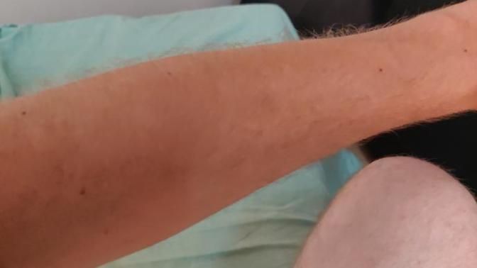 How do I take better care of my skin?