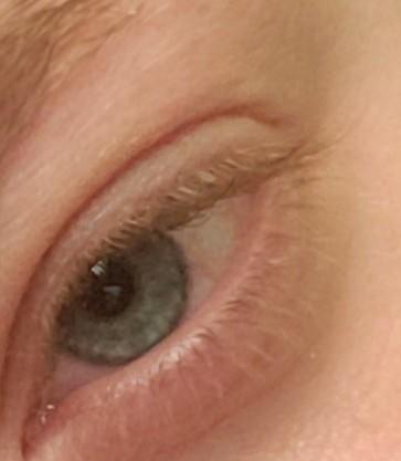Do your eyes change shades?