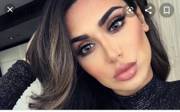 What do you think about the trend of getting lip injections in the USA?