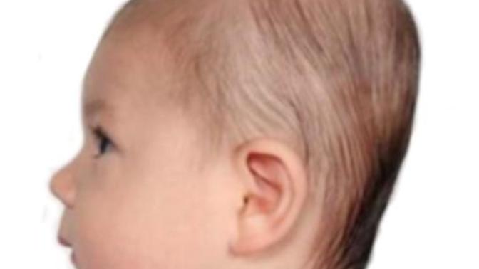 Would You Date Someone W/ A Flat Head?