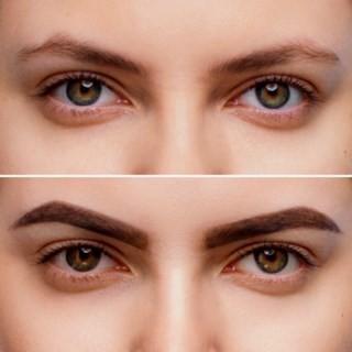 What is your worst facial feature??