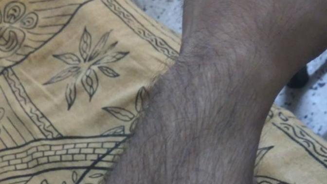 Please suggest me if I should do full body waxing (see the pic)?
