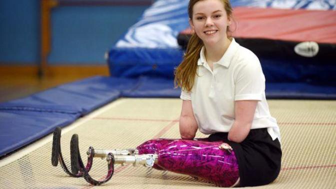 Are disabled and amputee women on YouTube the new trend?