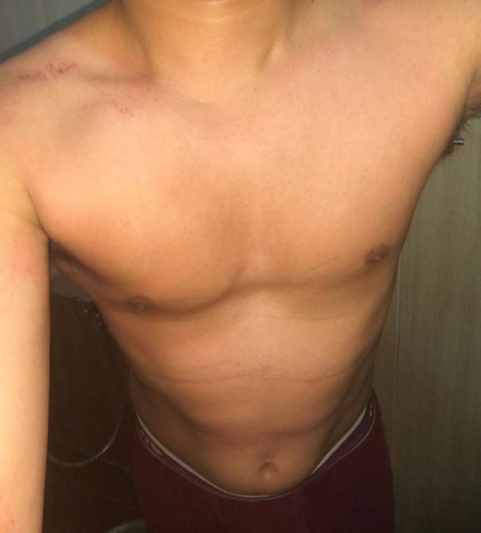 I do I (27 male) look after waxing (see pics in description)?