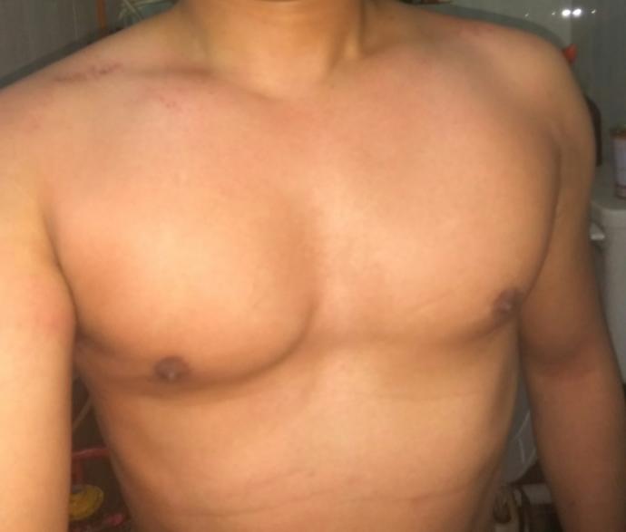 I do I (27 male) look after waxing (see pics in description)?