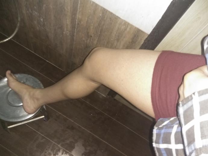 I do I (27 male) look after waxing (see pics in description)?