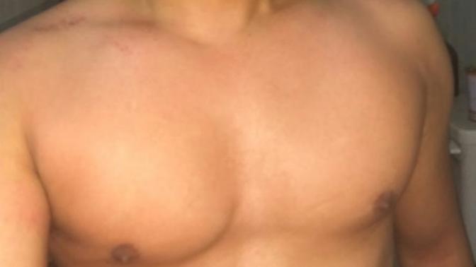 I do I (27 male) look after waxing (see pics in description)?