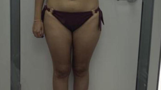 I have no access to the gym and I want to burn fat and tone my stomach legs and butt and get rid of waistwill these exercises help if I do them daily?
