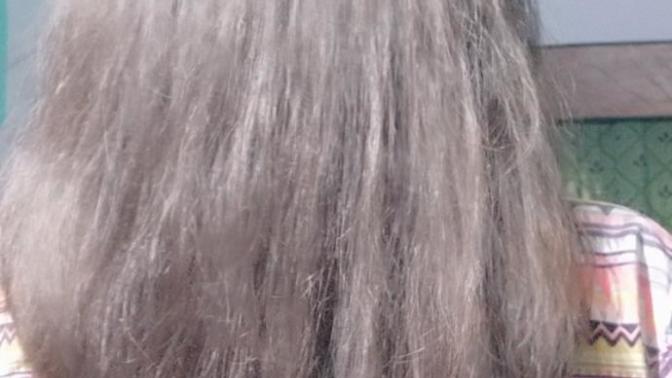 Damaged hair recovery?