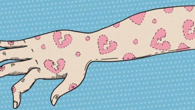 How would you feel if you found out your partner has a skin condition?