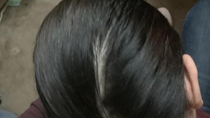 Girls, do I have a bald spot (pictures) ?