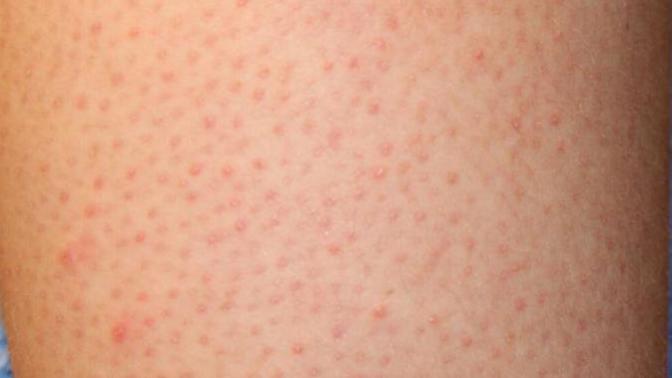 Would you date a girl with skin like this?
