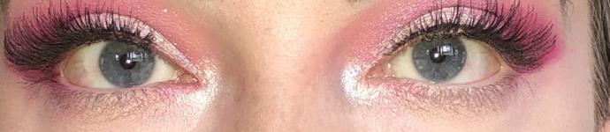 Does the white of my eye look yellow?